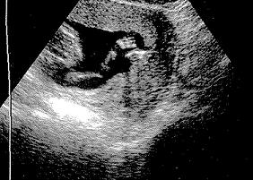 Litmock Baby Waving to the World